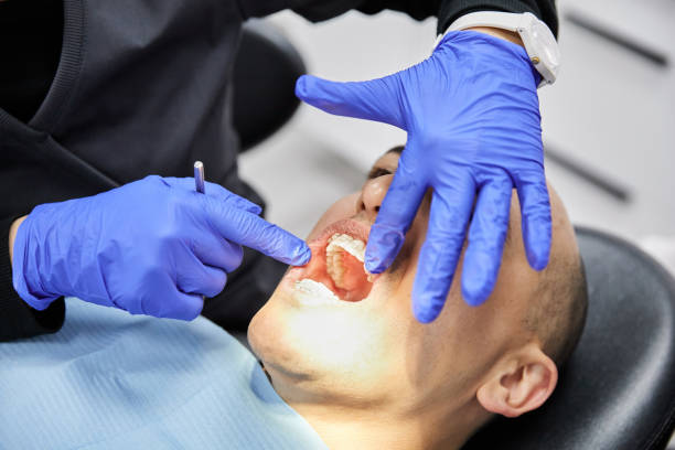 Best Emergency Dental Care for Broken or Chipped Teeth in Keeseville, NY